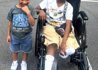 Coping with Limb Loss